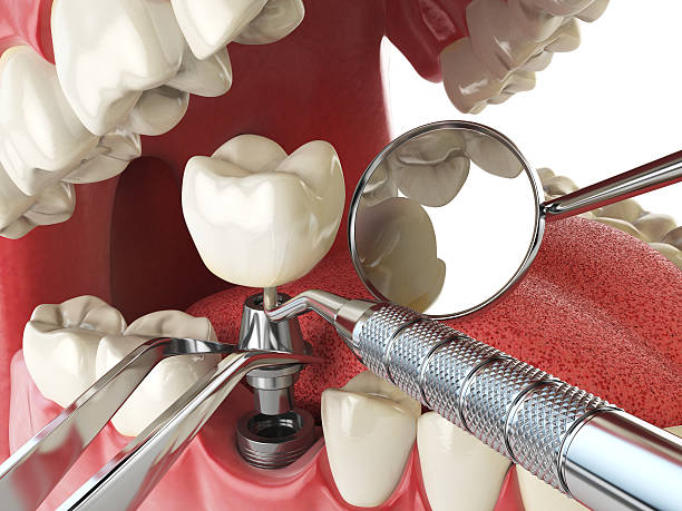 Best Emergency TMJ Treatment in Cloverport, KY